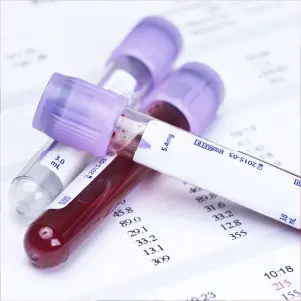 TRT Testosterone Treatment 25 Wellness Panel